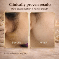 Cyperus Rotundus Oil