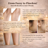 Cyperus Rotundus Oil